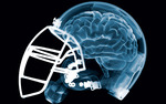 Photo gallery image named: tgc-brain-helmet.jpg